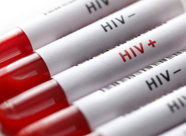 Untore dell’Hiv: il pm chiede l’ergastolo