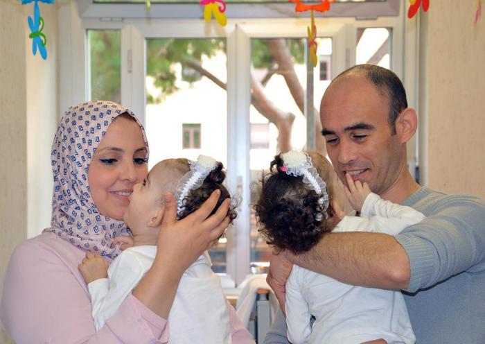 Roma, separate gemelle siamesi algerine: stanno bene