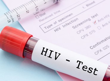 Diminuiscono i casi di Hiv in Italia, ma è Sos per i più giovani