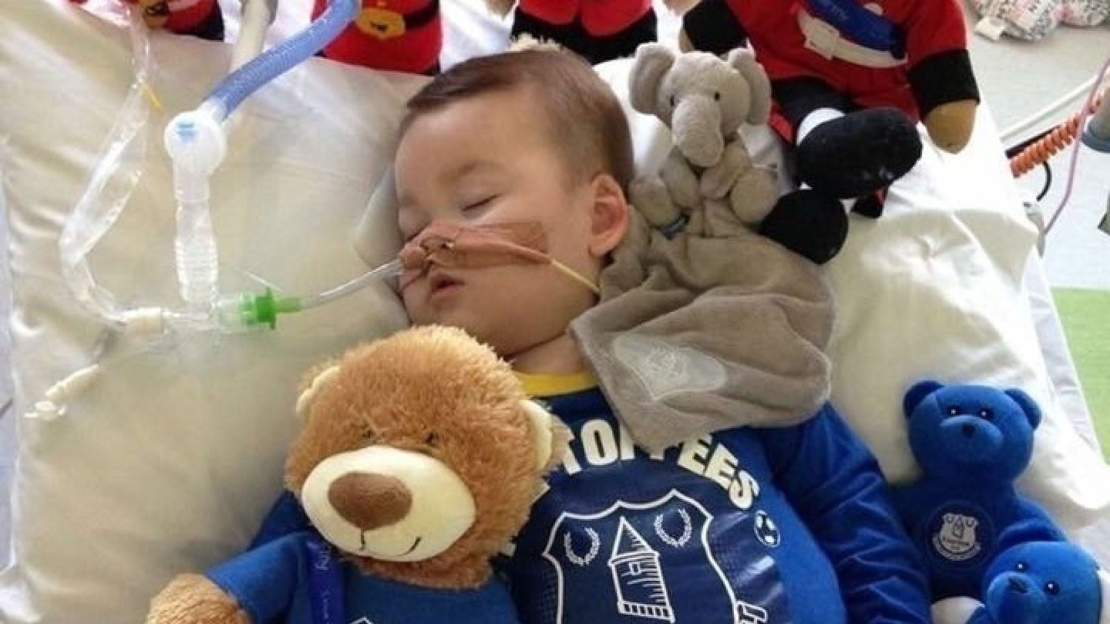 Il piccolo Alfie Evans resiste