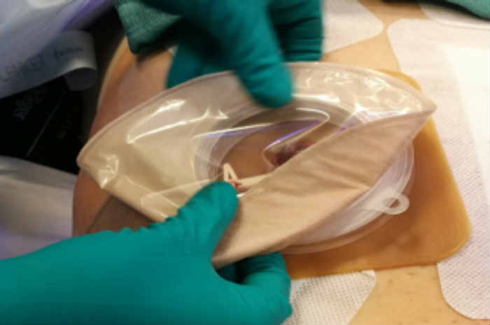 “Stomie: sanità militare e sanità civile a confronto”