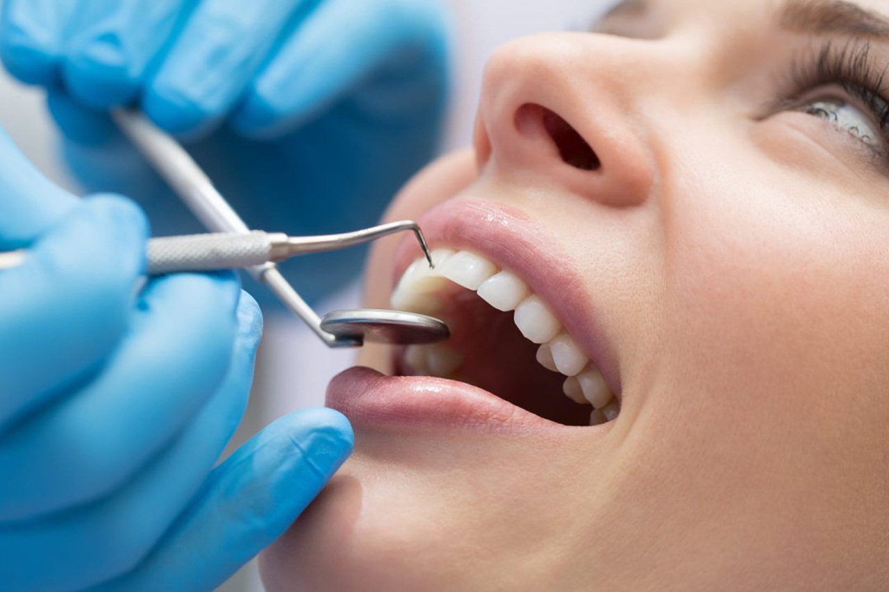 “L’Opinione risponde”: carie e omeopatia