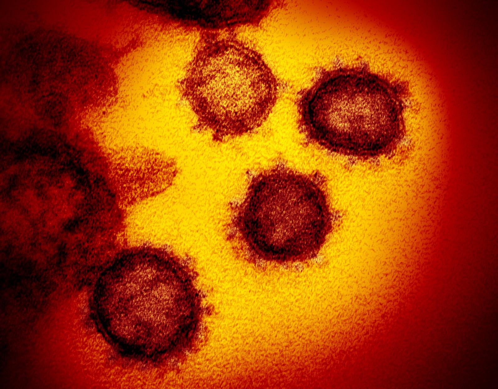Coronavirus: super anticorpi contro la pandemia 