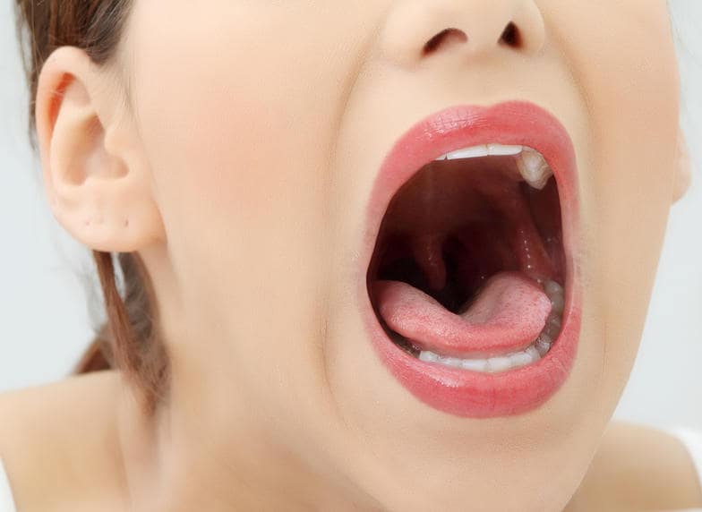 L’Opinione risponde: la Sindrome di Sjogren