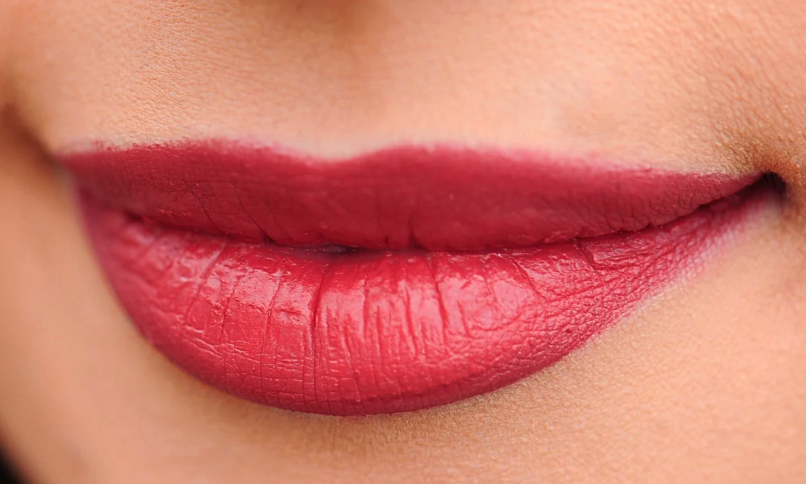 L’Opinione risponde: medicina estetica in giovane età 