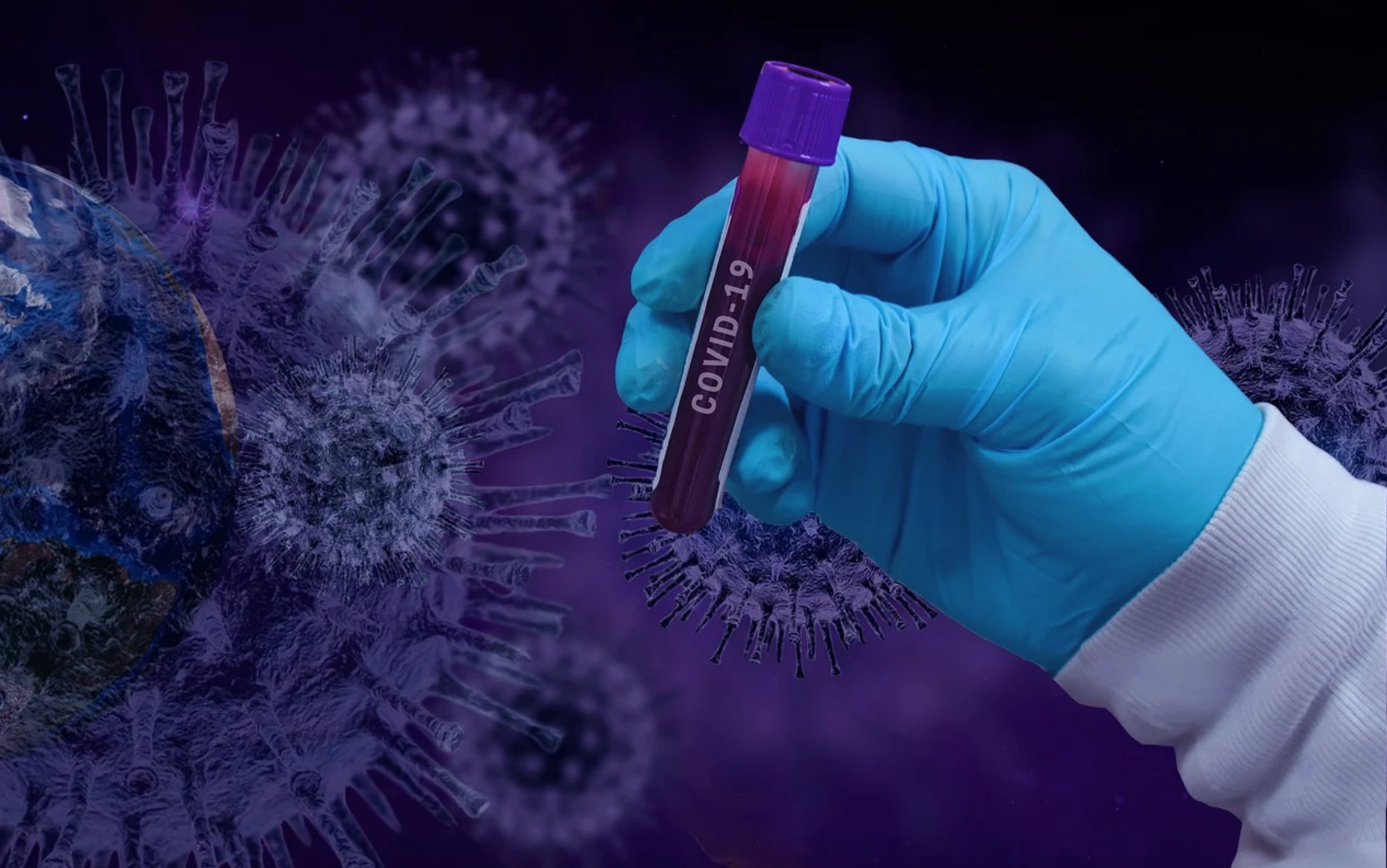 La quasi certa origine di laboratorio del Coronavirus