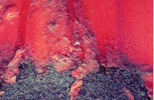 L’eruzione cutanea