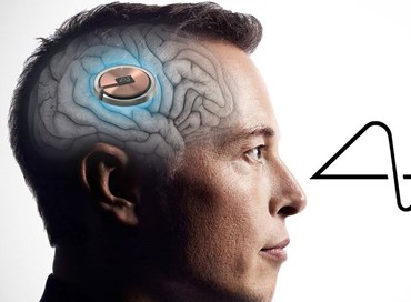 Elon Musk installa il primo chip cerebrale su un uomo
