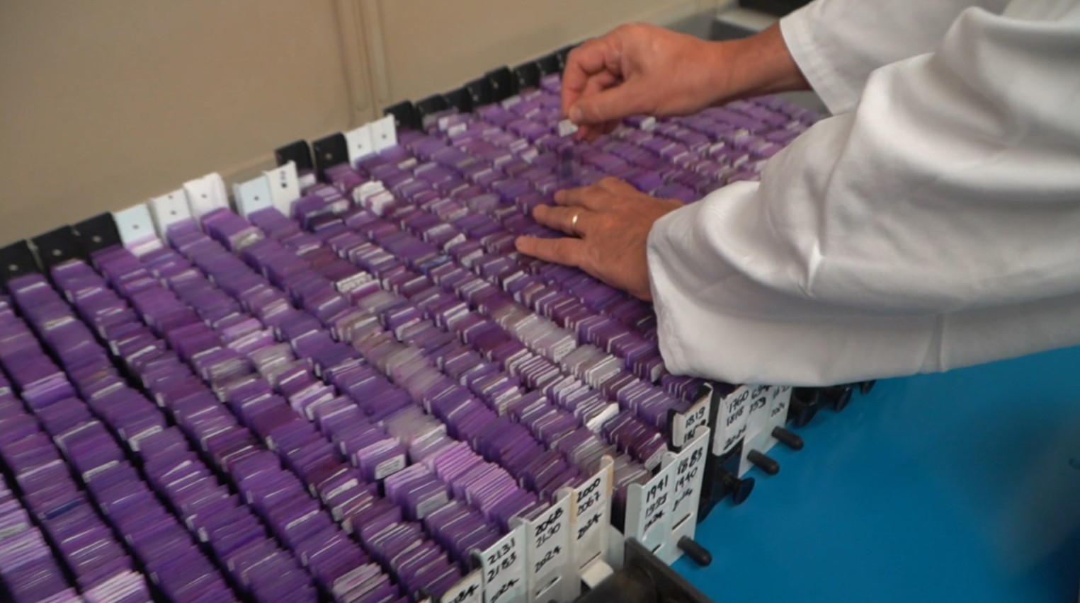 Giornata di sensibilizzazione sull’emoglobinuria parossistica notturna