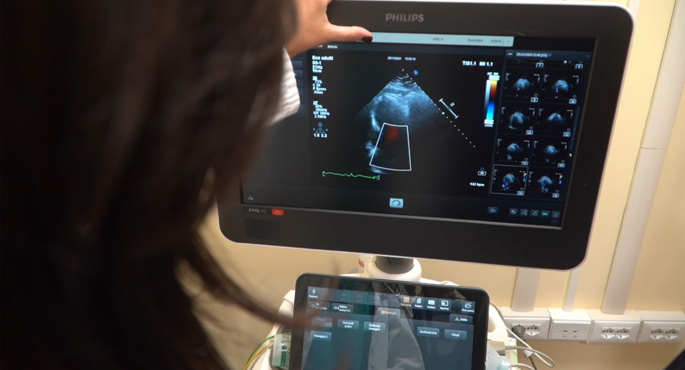 “Da quore a cuore”, la sensibilizzazione sul colesterolo “cattivo” Ldl 