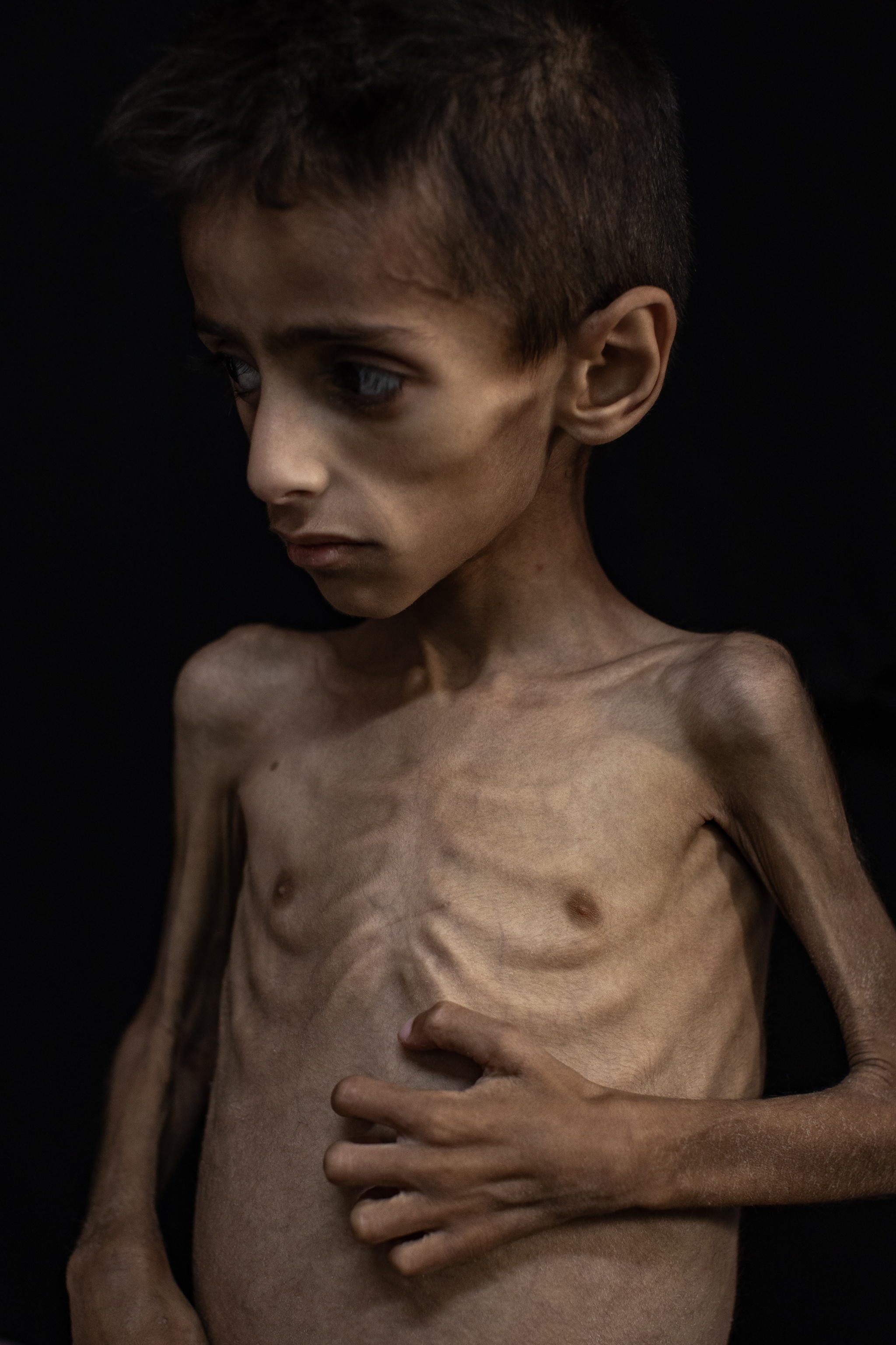 La foto-truffa sulla fame a Gaza