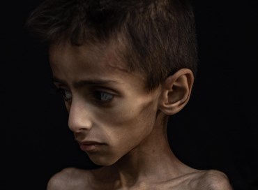 La foto-truffa sulla fame a Gaza